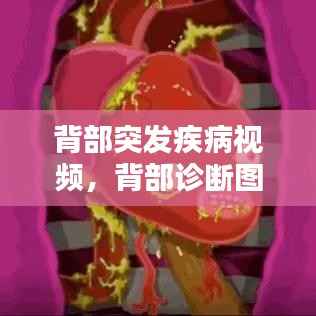 背部突发疾病视频，背部诊断图 